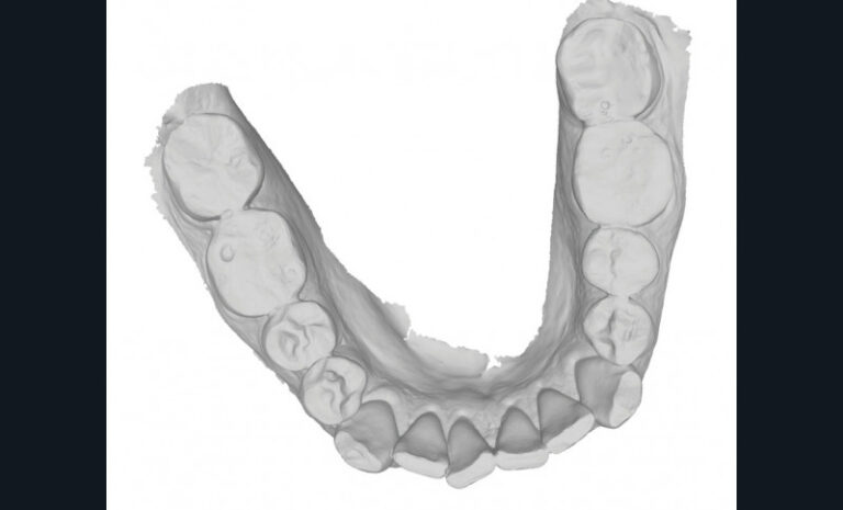 d. Vue occlusale mandibulaire.