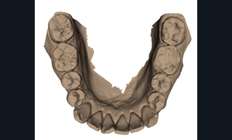 d. Vue occlusale mandibulaire.