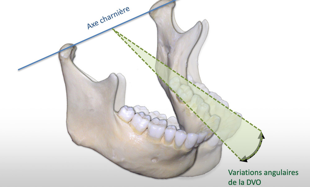 Articles en chirurgie dentaire et orthodontie Id Webformation — free download