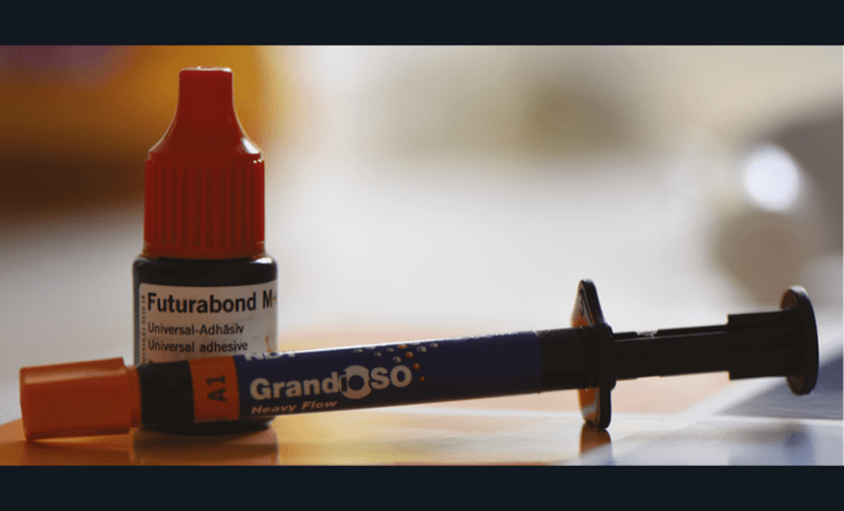 6. Adhésif (Futurabond® M+, Voco) et composite fluide (Grandio®SO Heavy Flow, Voco), utilisés pour le cas clinique.