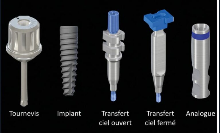 3. Accastillage nécessaire pour une empreinte sur implants.