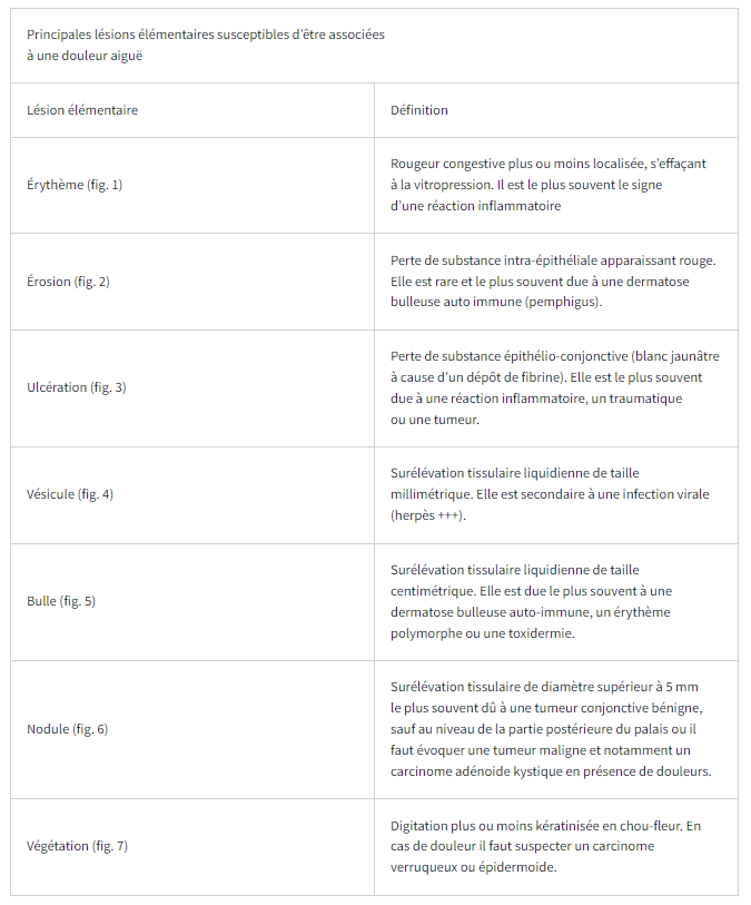 tableau article