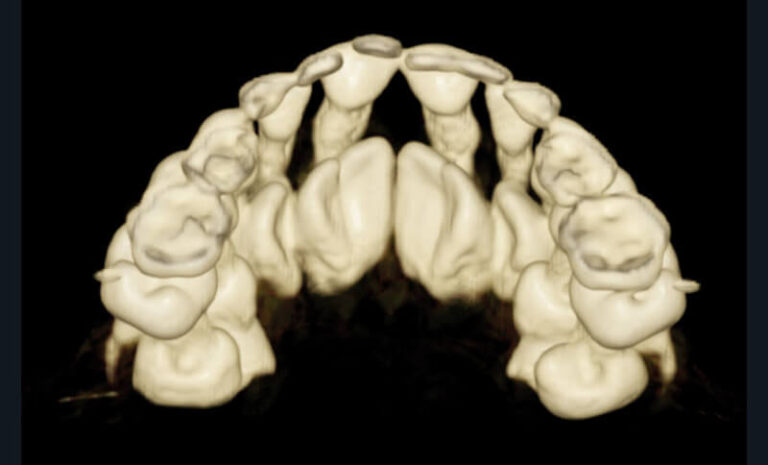 b) Reconstruction 3D (appareil CBCT NewTom® 5g, Quantitative Radiology®).