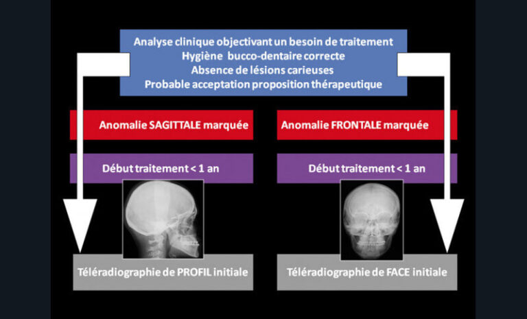 Fig. 8 - Arbre décisionnel concernant les indications de réalisation des téléradiographies de face et de profil.