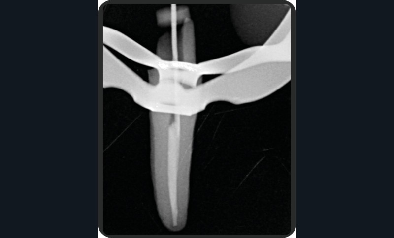 fig_5_ok2-tt-width-800-height-484-fill-1-crop-0-bgcolor-12181f-isLogoProxy-0-post_id-218244