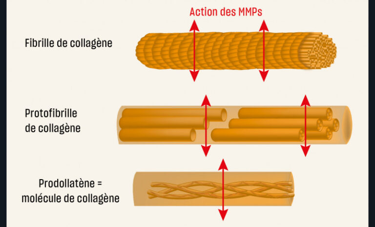 5. Représentation schématique de la dégradation des fibres des collagènes par les MMPs.