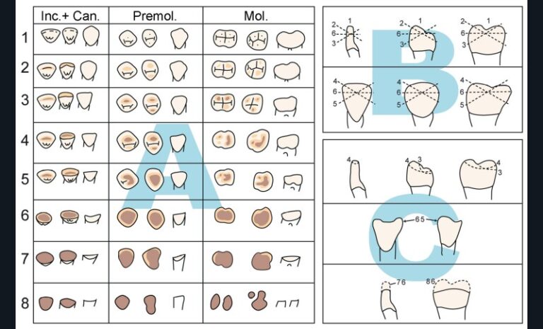 3. Classification de Molnar (1971) fréquemment utilisée pour coter l’usure des populations du passé. A = stade d’usure ; B= type d’usure – direction de la surface d’usure ; C = types d’usure – forme de la surface d’usure [10].