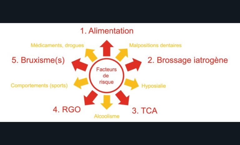 4. Principaux facteurs de risque de l’usure dentaire pathologique (RGO : reflux gastro-œsophagien ; TCA : trouble des conduites alimentaires).