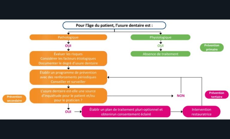 5. Conseils thérapeutiques et mesures de prévention appropriées selon la nature physiologique ou pathologique de l’usure dentaire. Adapté de Loomans et al. [25].