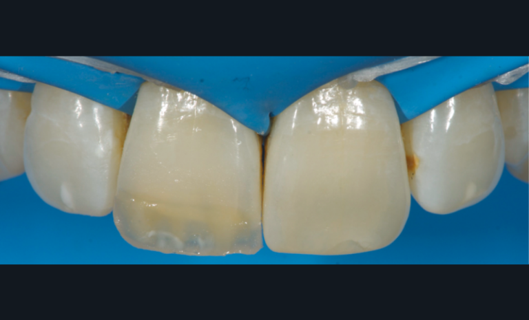 k. Caractérisation par adjonction de légères taches blanches (White Modifier).