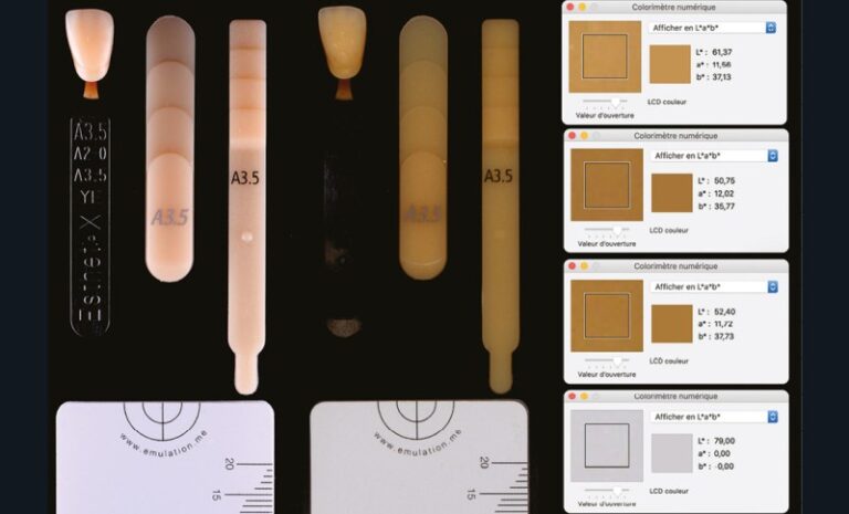 17. Pour un référentiel Vita Classical identique (ici A3,5), l’étude colorimétrique de trois teintiers de marques différentes (Esthet.X® HD, Gradia® Direct et Tetric® Evoceram) démontre sans équivoque, à travers les valeurs numériques L, a, b, des différences de couleurs.