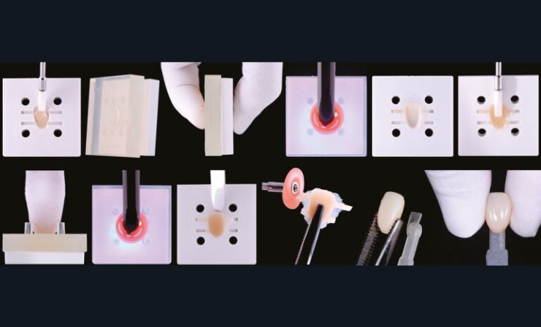 21. Pas à pas de la fabrication du teintier personnalisé My Shade Guide (Smile Line®). Moule divisé en deux parties, une partie femelle en silicone rigide et une partie mâle en silicone souple transparent permettant le passage de l’insolation lumineuse de la lampe à photopolymériser.