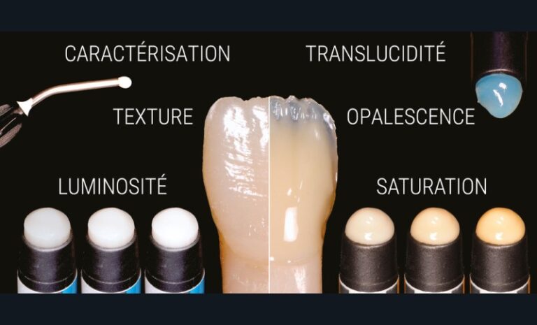 Synthèse des paramètres colorimétriques majeurs en dentisterie restauratrice directe