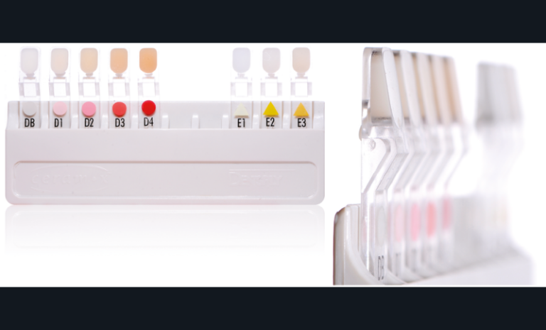 7. Les échantillons du teintier sont ici encadrés d’une bordure en plastique transparent qui parasite le choix de couleur. La nature du matériau employé n’est pas identique au système de résine composite auquel il est dédié et les épaisseurs sont en totale inadéquation avec celles employées en pratique.
