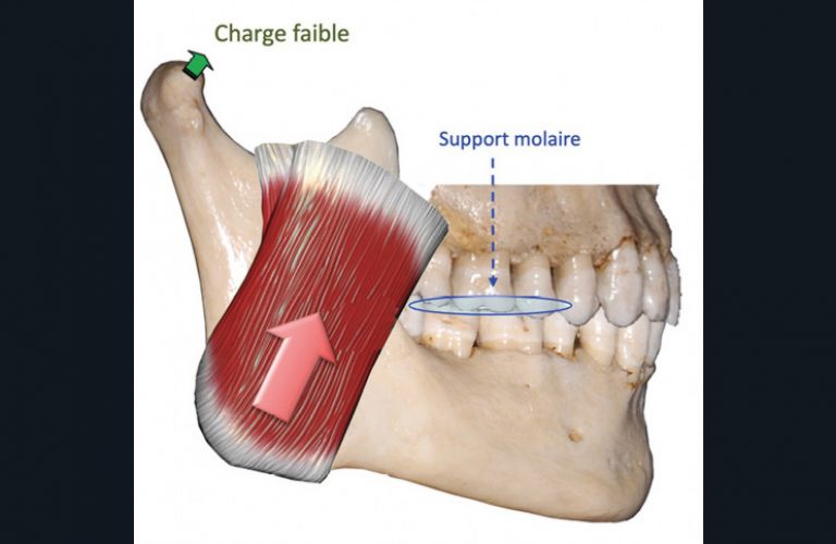 7. Support molaire : le serrement en OIM ne génère pas de contraintes articulaires, les forces élévatrices étant absorbées par le support molaire.