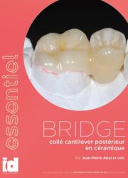bridge-cantilever-bd-tt-width-680-height-874-fill-0-crop-1-bgcolor-eeeeee-isLogoProxy-0-post_id-163447 bridge-cantilever-bd-tt-width-680-height-874-fill-0-crop-1-bgcolor-eeeeee-isLogoProxy-0-post_id-163447
